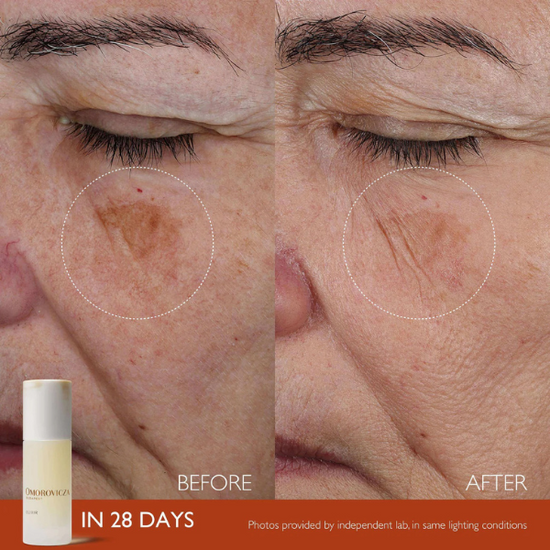 OMOROVICZA Elixir 30 ml- wzmocnione serum przeciwzmarszczkowe