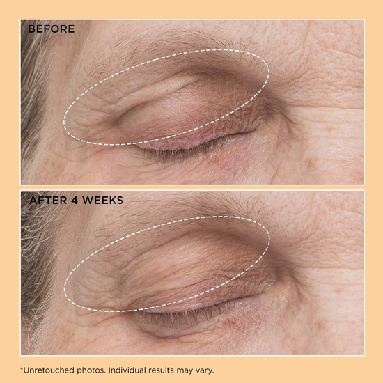 PERRICONE MD Neuropeptide Eyelid Lift Serum 15ml - liftujace serum na górną powiekę i okolice oczu