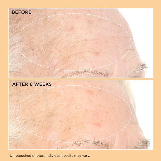 Perricone MD Neuropeptide Pro-Strength Firming Moisturizer 59ml- nawilżający krem poprawiający gęstość, jędrność i sprężystość skóry