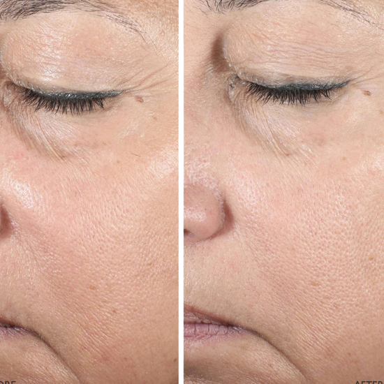 OMOROVICZA  Queen Serum 5 ml- Odmładzające serum do twarzy