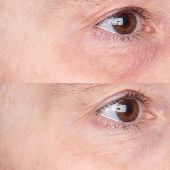 PERRICONE MD Cold Plasma plus+ Daily Defense Moisturizer SPF 35 30ml - ochronny krem z kolagenem z spf 35