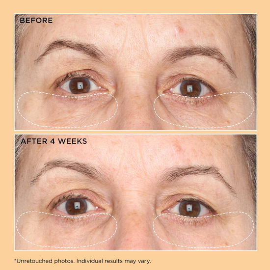 PERRICONE MD Neuropeptide Corrective Brightening Under-Eye Cream 15ml- 