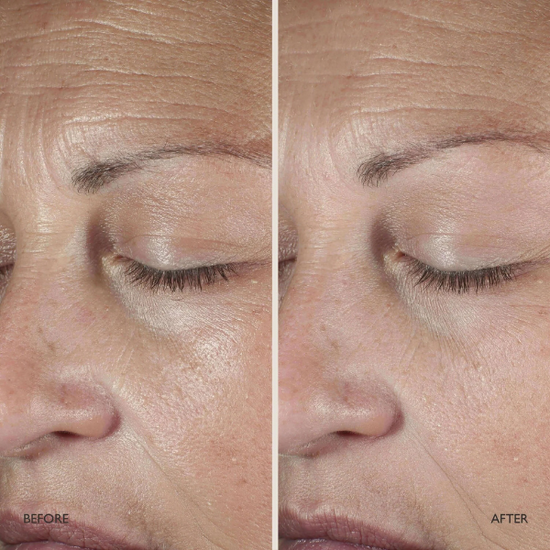 OMOROVICZA  Queen Serum 30 ml- Odmładzające serum do twarzy