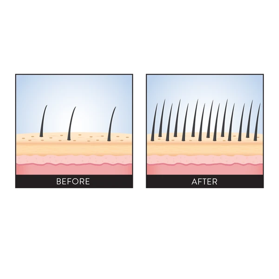  PHILIP B Scalp Booster 58ml - stymulujący olejek zapobiegający wypadaniu i przerzedzaniu się włosów