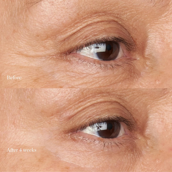 PERRICONE MD  Hypoallergenic Clean Correction Firming & Brightening Eye Cream 15ml - ujędrniający krem pod oczy z peptydami